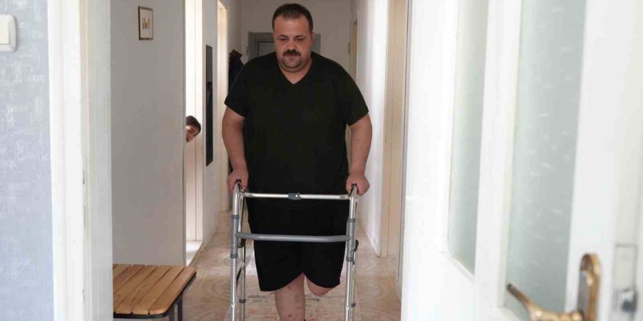 Terapi Sonrası Felaket: Tedavi İçin Gitti, Ayağı Kesildi