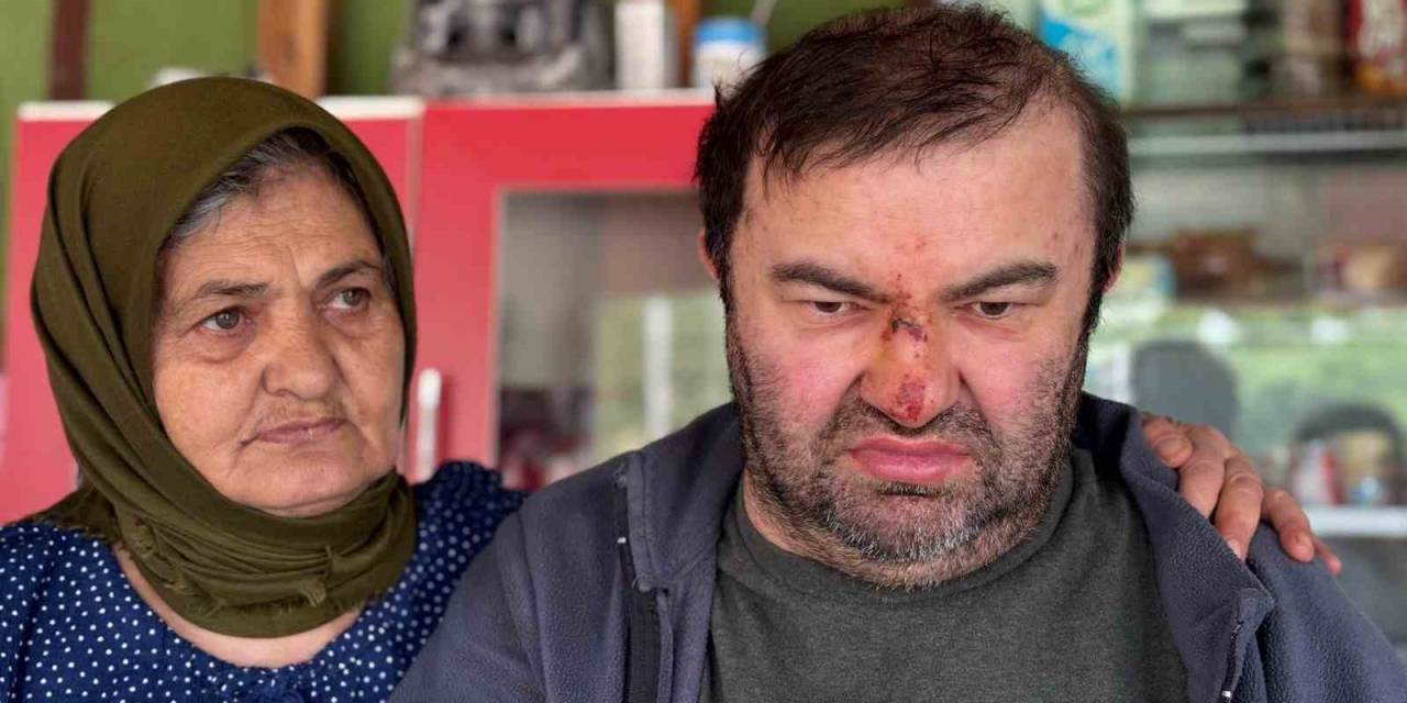 Yüzde 90 Engelli Vatandaş Acımasızca Darp Edildi