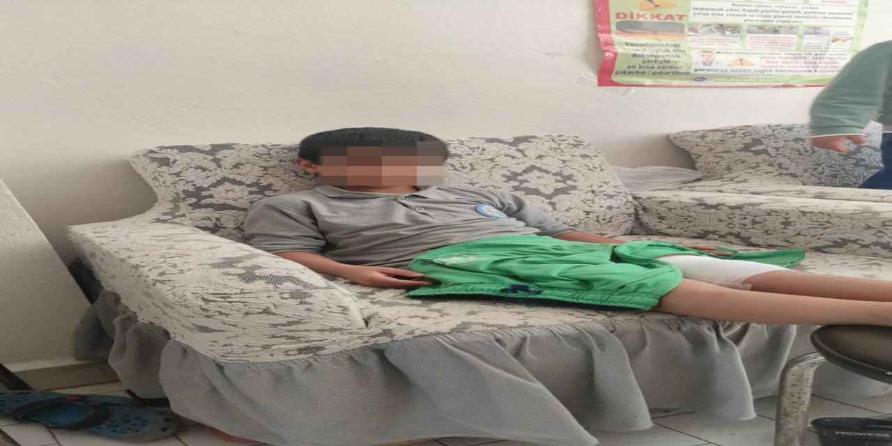 Okula giderken sokak köpeğinin saldırısına uğradı