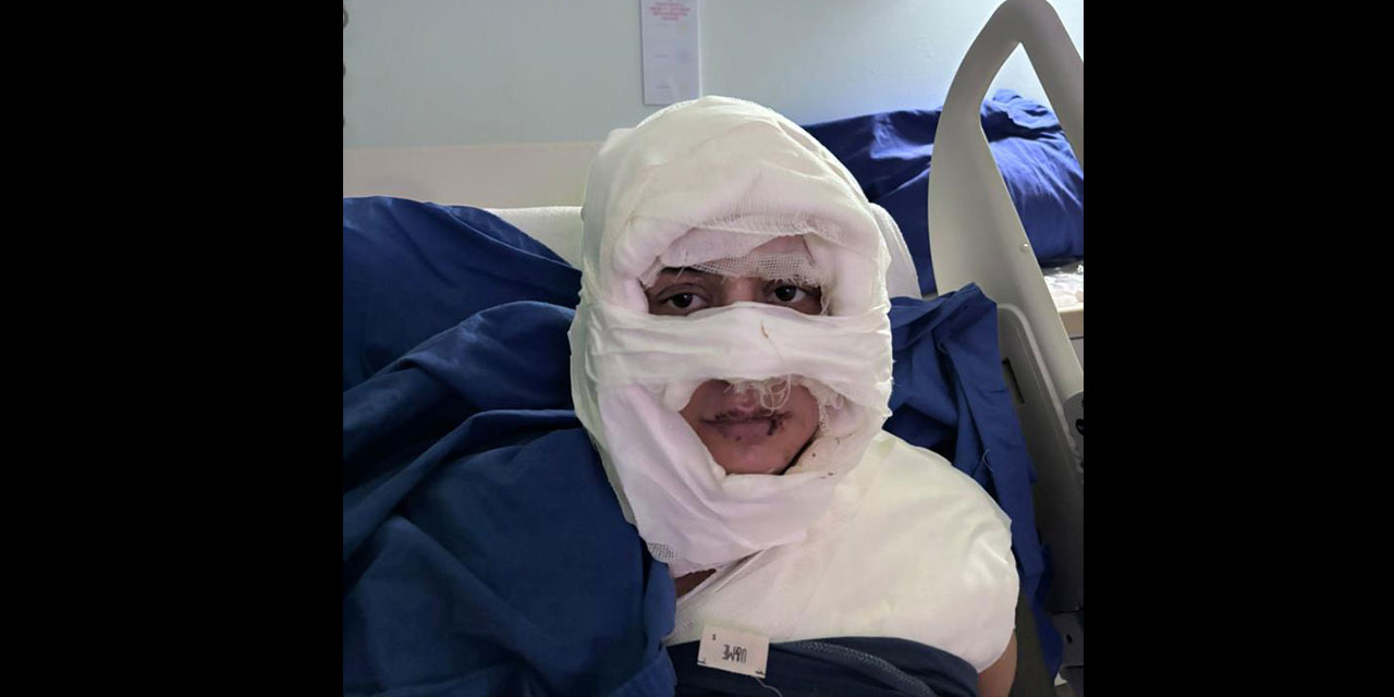 Kadıköy'de akıl almaz olay: Genç kadın başka bir kadın tarafından ateşe verildi