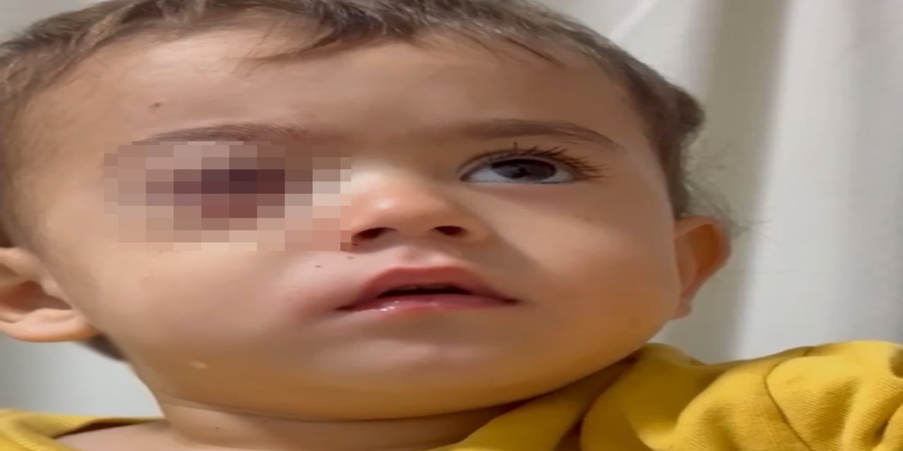 Bursa'da, 2 yaşındaki Alpaslan'ın görme yetisini kaybetmesine neden olan torpil, fırından alınmış