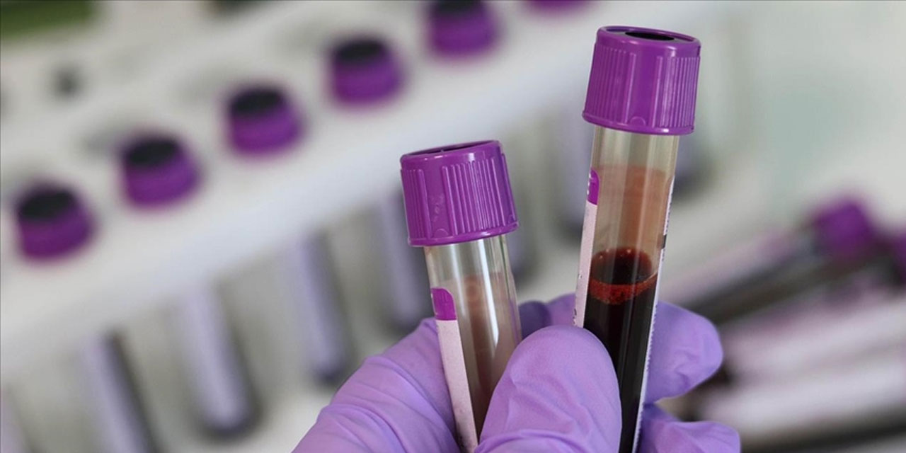 Kan kanserinde "immünoterapilerle" tedavide yeni dönem