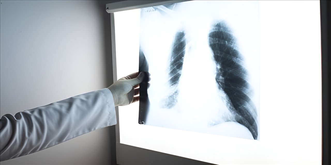 Sık yaşanan viral enfeksiyonlar akciğer kapasitesini düşürüyor