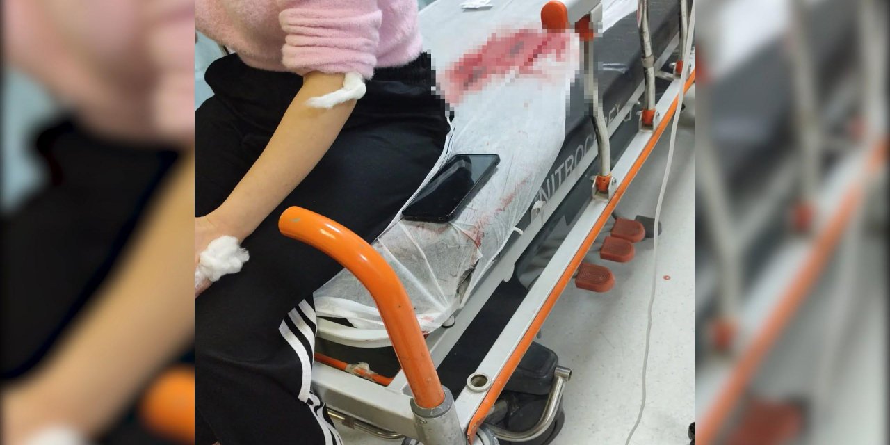 Görümce, akaryakıt istasyonunda eski yengesini bıçakladı