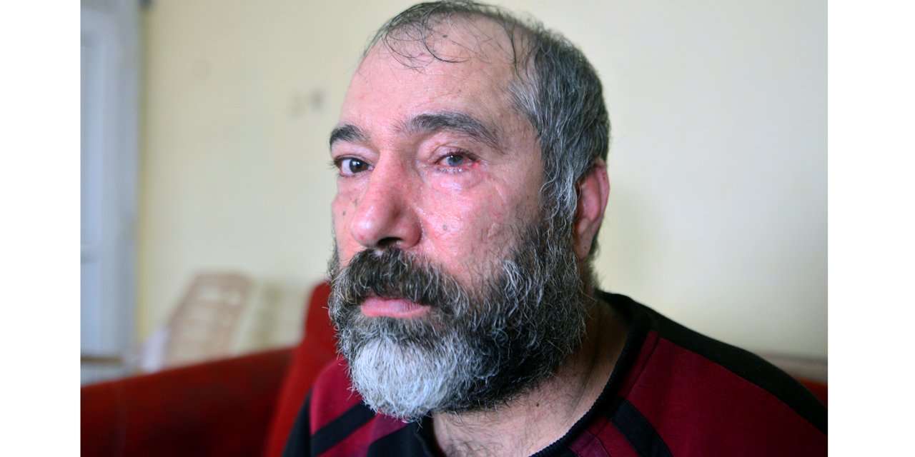Durakta ‘küfür’ tartışmasında bardakla vurulan gözünü kaybetti, şüphelinin tutuklanmasını istiyor