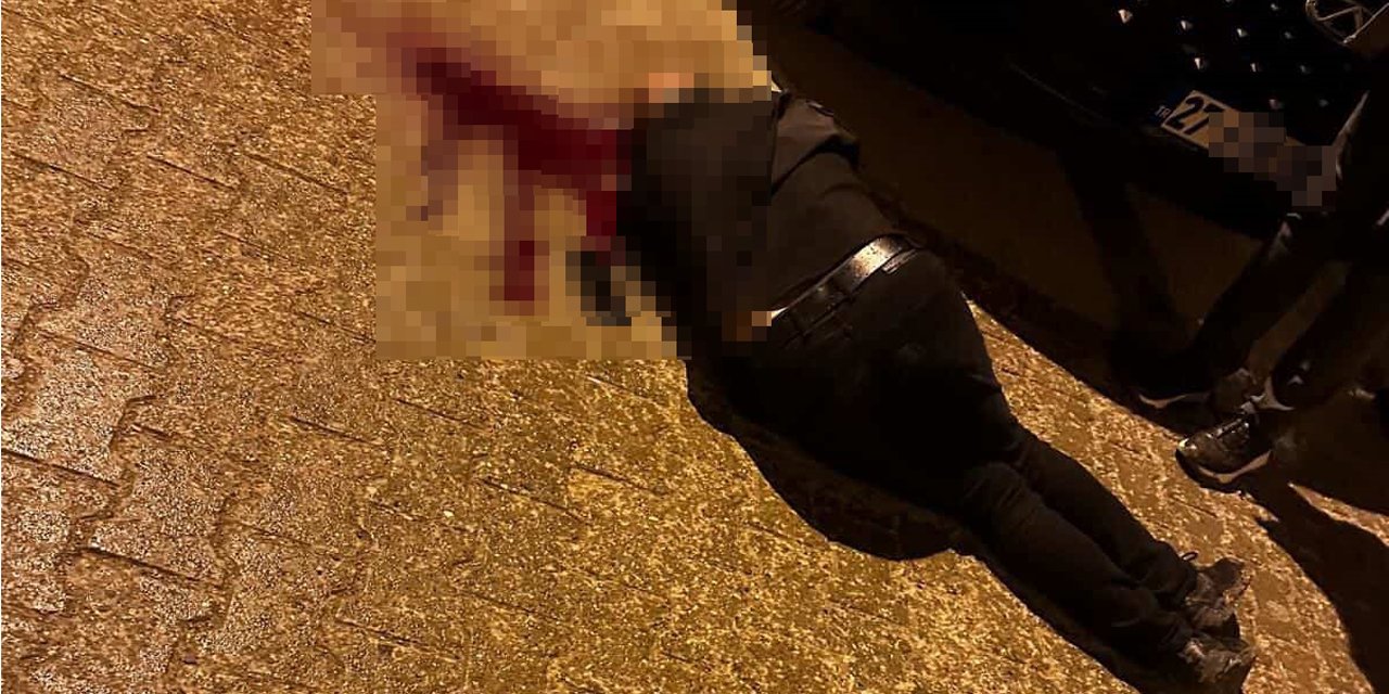 Sokakta yürürken tabanca ile başından vuruldu