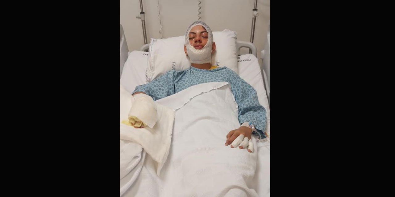 Ateşe benzin döktü, facianın eşiğinden döndü