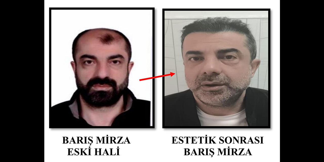 Cinayete azmettirmekten aranan şüpheli, ameliyatla yüzünü değiştirmiş