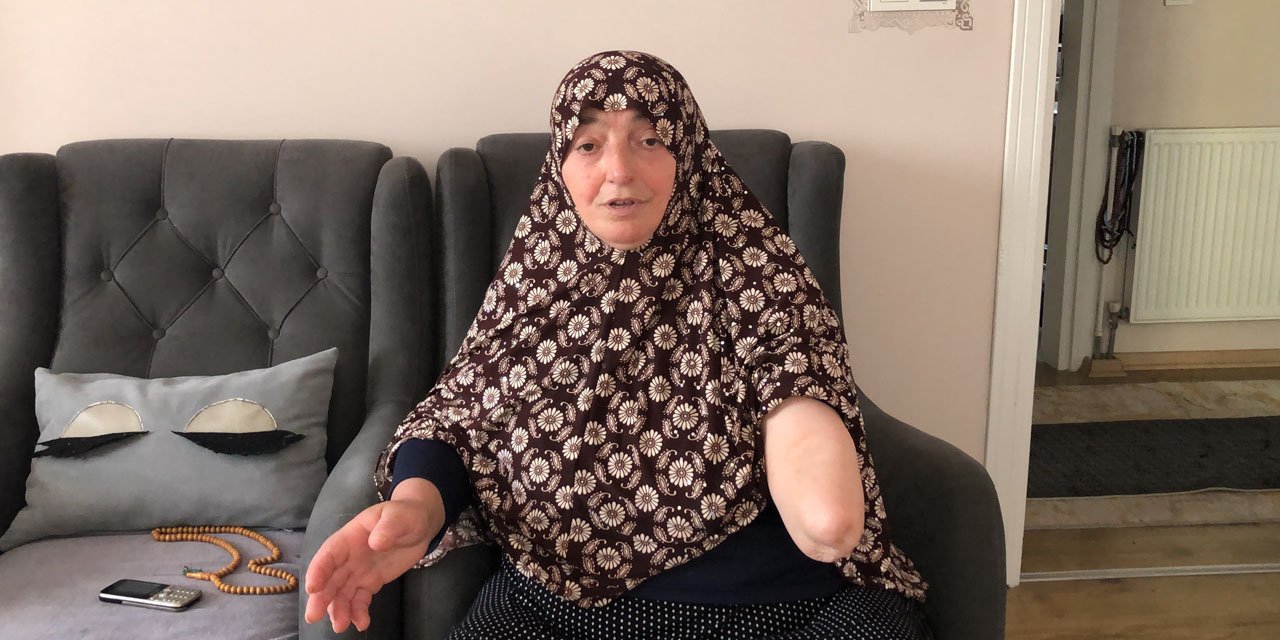 Köpekler kolunu parçaladı, gözleri açık gitti