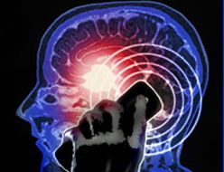 Beyin tümörünün 6 habercisi