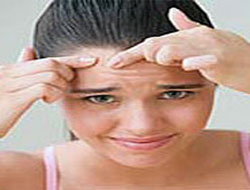 İşte sivilcelerin nedeni!