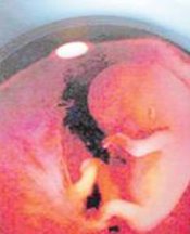 Tüp bebekte yeni dönem