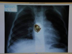 36 Yıllık Doktorun Sıra Dışı Koleksiyonu