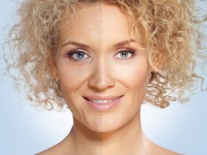 Yüz Germede Ameliyatsız Devrim