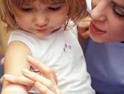 Su çiçeği nasıl tedavi edilir?