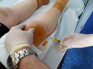 Diz Ağrıları Prp İle Tarih Oluyor