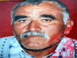 Samsun'da KKKA şüphelisi hasta hayatını kaybetti