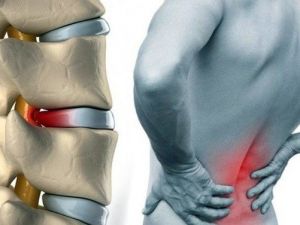 Uzman Dr. Sulu: "Her Bel Ağrısı Fıtık Olmayabilir"