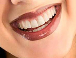 Diş dolgusu tarihe karışıyor!