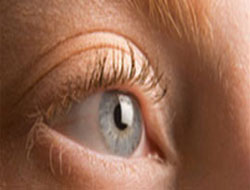 Gözleriniz mi şişiyor ?