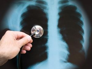 1-5 Yaş Arası Çocuklarda Zatürre Riski 2 Kat Fazla