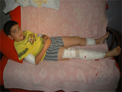 Rize'de 2. Köpek Faciası!