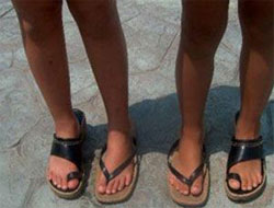 Parmak arası terlikler aslında çok zararlı!