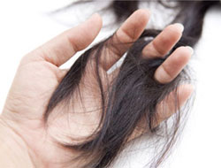 Saç Dökülmesine Dikkat Edin