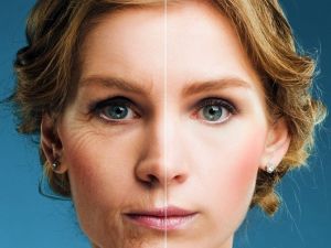 Yüz Gençleştirme Sayesinde Yaşlanmaktan Korkmayın