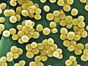 Kanserin sekiz işaretine dikkat