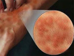 Şok geçirmemek için bunlara dikkat!