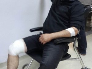 Samsun’da Silahlı Saldırı: 1 Yaralı
