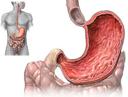 İlk mide kanseri ameliyatı yapıldı