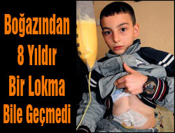 Boğazından 8 Yıldır Lokma Geçmedi!