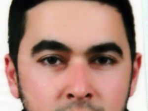 Türkiye’nin 3. Kol Nakli Antalya’da Başladı