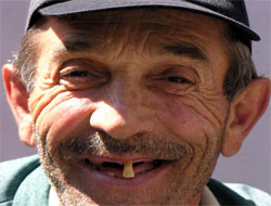 Dişiniz kırılınca "işe yaramaz diye" atmayın