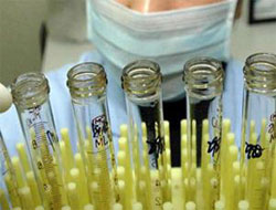 Tüberküloz tespitinde devrim!