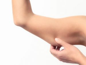 Sallanan Kollar İçin Bir Çözüm De Kol Germe Ameliyatları