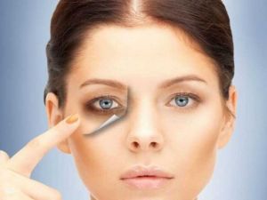 Gözaltı Morluğuna Ve Torbalanmalarına Son