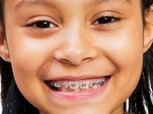 Tırnak Yeme Alışkanlığı Dişlere Zarar