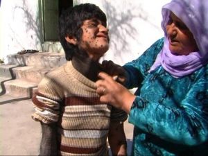 10 Yaşındaki Suriyeli Kızın Dramı Yürek Burkuyor