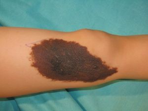 Prof. Dr. Özgür: "Bütün Benlerin Alınması Gerekmiyor"