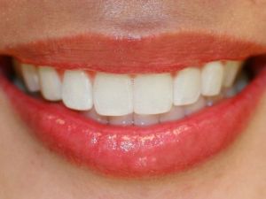 İnsanların Yüzde 7’si Gülmekten Kaçınıyor