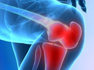 Protez Ameliyatı Sonrası Fizik Tedavi Büyük Önem Taşıyor