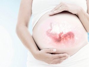 Bebekte Gelişme Geriliği