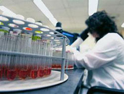 Rize'de Domuz Gribinden 1 Kişi Öldü