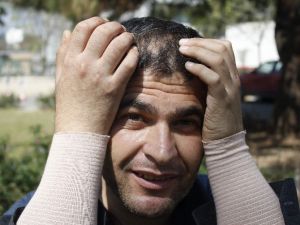 Çift Kol Nakilli Mustafa Sağır’ın Hayali Cumhurbaşkanı İle Tokalaşmak