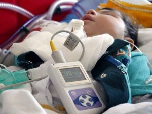 2 Yaşındaki Taha’nın, 5 Ayrı Makineyle Yaşam Mücadelesi