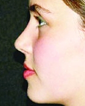 Sağlık için burundan nefes alın