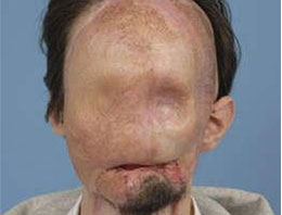 Tıp tarihinde bir ilk gerçekleştirildi